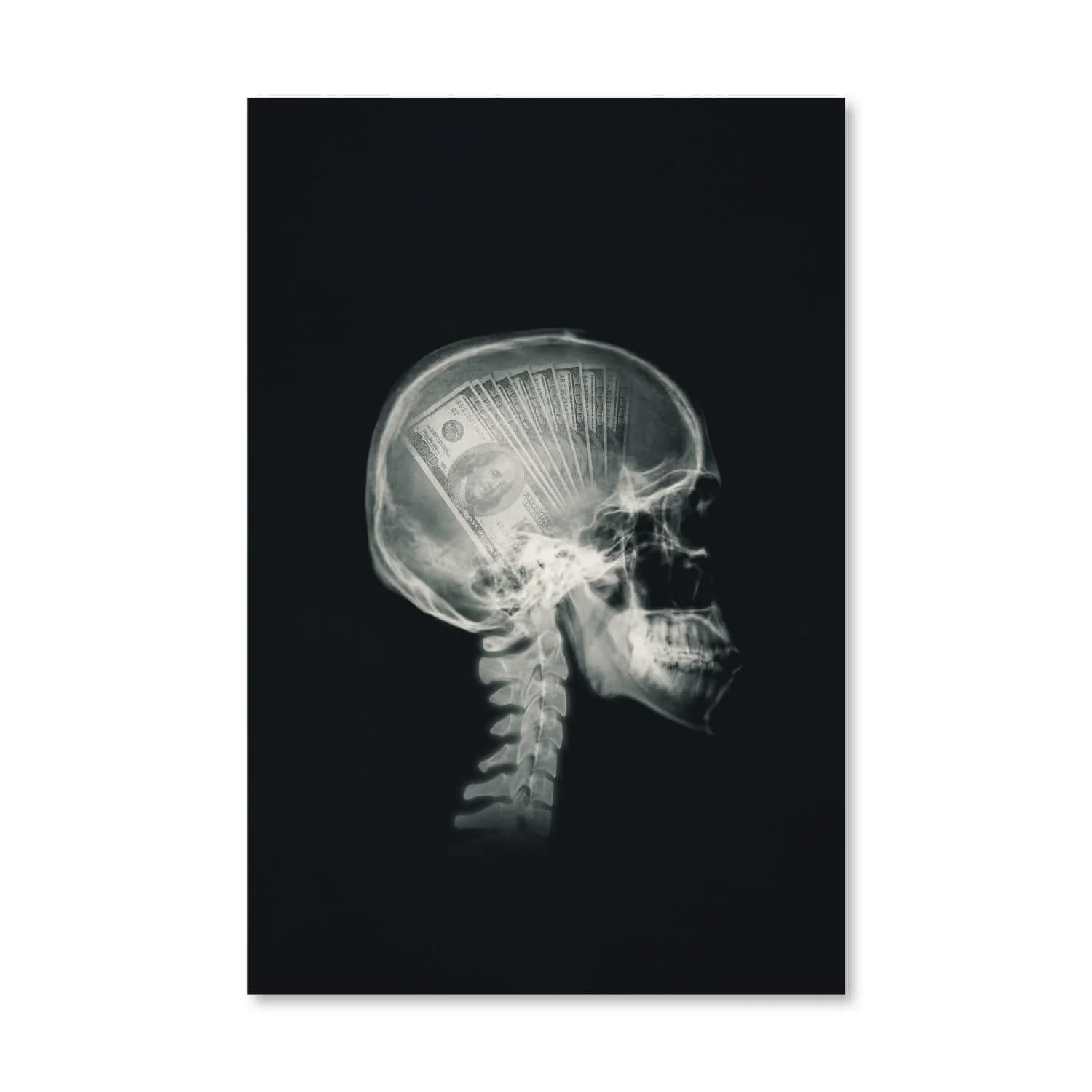 Money Mind X-ray Canvas - Image 7